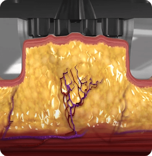 InMode Ocean Clinic Ocean Clinic Gangnam Dermatology Services inmode-ocean-clinic-ocean-clinic-gangnam-dermatology-services